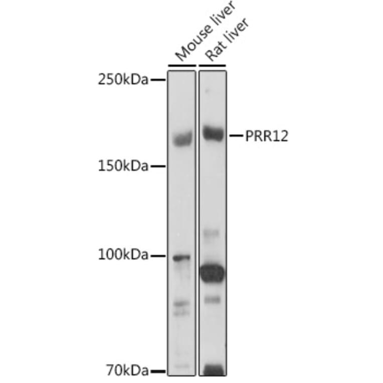 Western Blot - Anti-PRR12 Antibody (A306018) - Antibodies.com