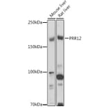 Western Blot - Anti-PRR12 Antibody (A306018) - Antibodies.com