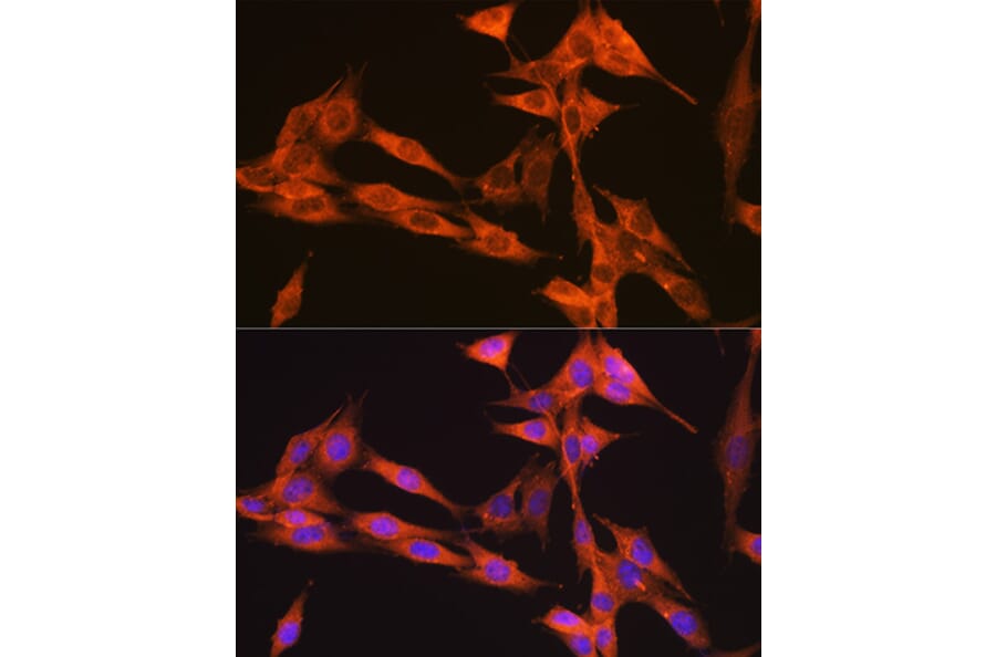 Immunofluorescence - Anti-VPS34 Antibody [ARC0286] (A306019) - Antibodies.com
