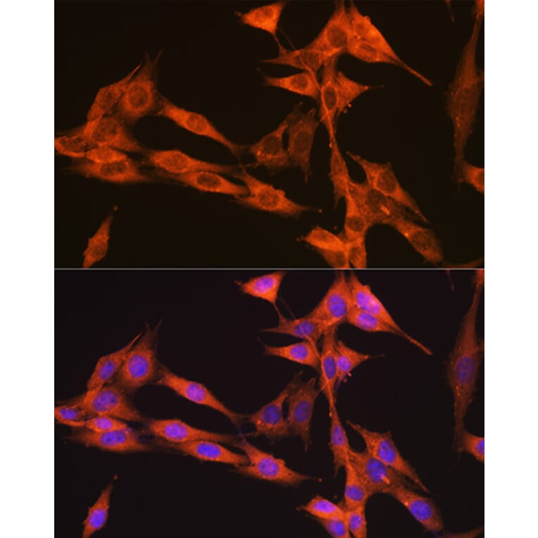 Immunofluorescence - Anti-VPS34 Antibody [ARC0286] (A306019) - Antibodies.com