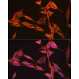 Immunofluorescence - Anti-VPS34 Antibody [ARC0286] (A306019) - Antibodies.com