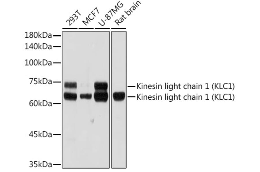 Western Blot - Anti-KLC1 Antibody [ARC2409] (A306023) - Antibodies.com