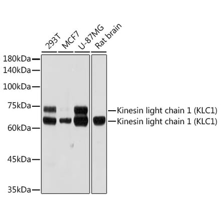 Western Blot - Anti-KLC1 Antibody [ARC2409] (A306023) - Antibodies.com