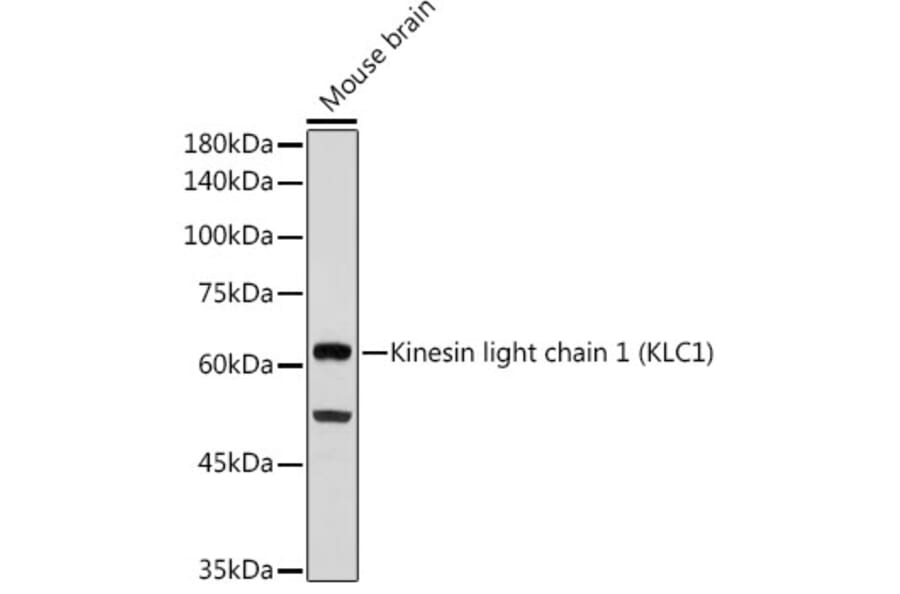 Western Blot - Anti-KLC1 Antibody [ARC2409] (A306023) - Antibodies.com