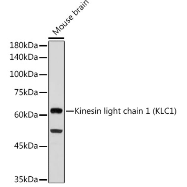 Western Blot - Anti-KLC1 Antibody [ARC2409] (A306023) - Antibodies.com