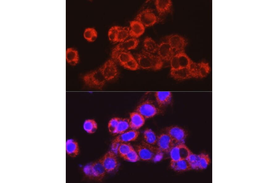 Immunofluorescence - Anti-UGT2B17 Antibody (A306025) - Antibodies.com