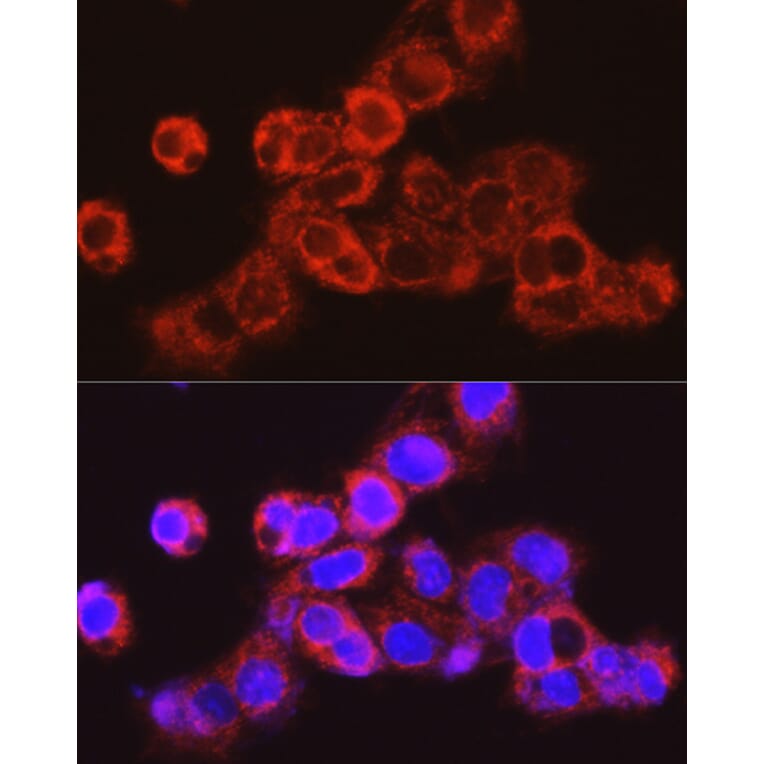 Immunofluorescence - Anti-UGT2B17 Antibody (A306025) - Antibodies.com