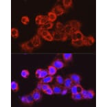 Immunofluorescence - Anti-UGT2B17 Antibody (A306025) - Antibodies.com