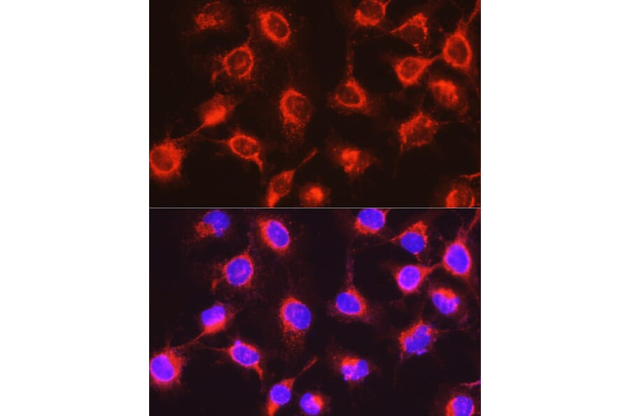 Immunofluorescence - Anti-UGT2B17 Antibody (A306025) - Antibodies.com