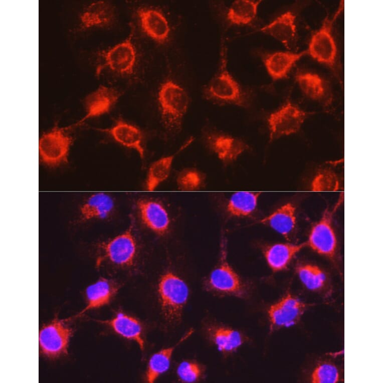 Immunofluorescence - Anti-UGT2B17 Antibody (A306025) - Antibodies.com