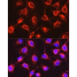 Immunofluorescence - Anti-UGT2B17 Antibody (A306025) - Antibodies.com