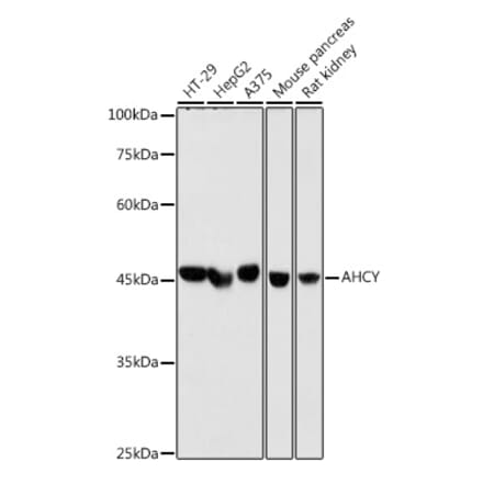 Western Blot - Anti-SAHH Antibody [ARC2674] (A306026) - Antibodies.com