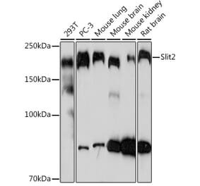 Western Blot - Anti-Slit2 Antibody [ARC2010] (A306027) - Antibodies.com