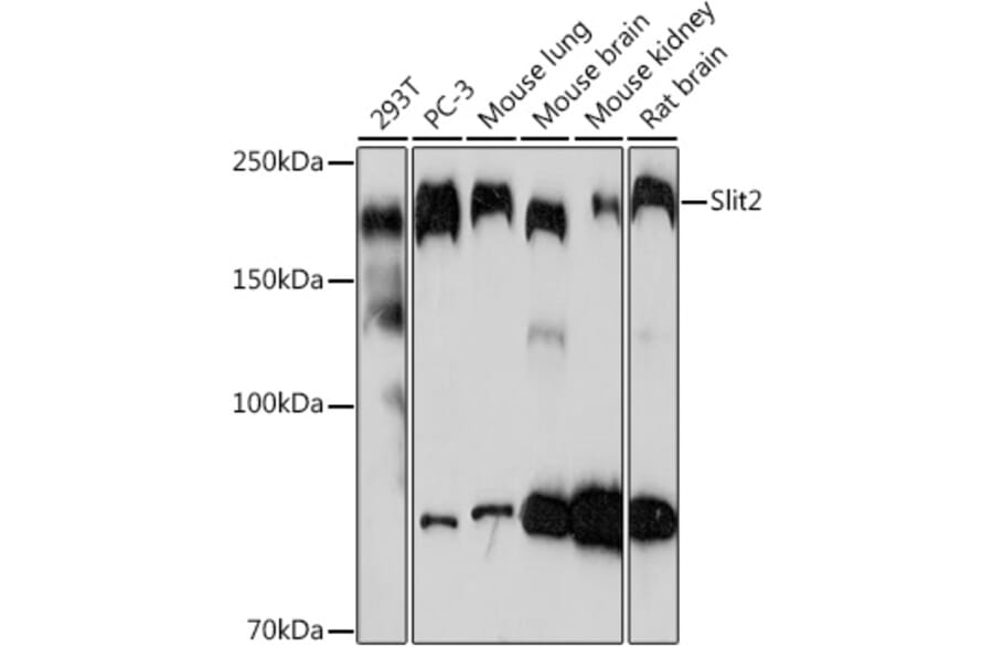 Western Blot - Anti-Slit2 Antibody [ARC2010] (A306027) - Antibodies.com