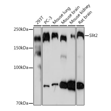 Western Blot - Anti-Slit2 Antibody [ARC2010] (A306027) - Antibodies.com