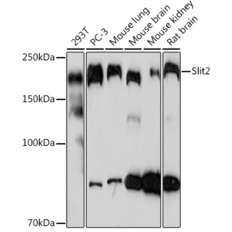 Western Blot - Anti-Slit2 Antibody [ARC2010] (A306027) - Antibodies.com