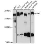 Western Blot - Anti-Slit2 Antibody [ARC2010] (A306027) - Antibodies.com
