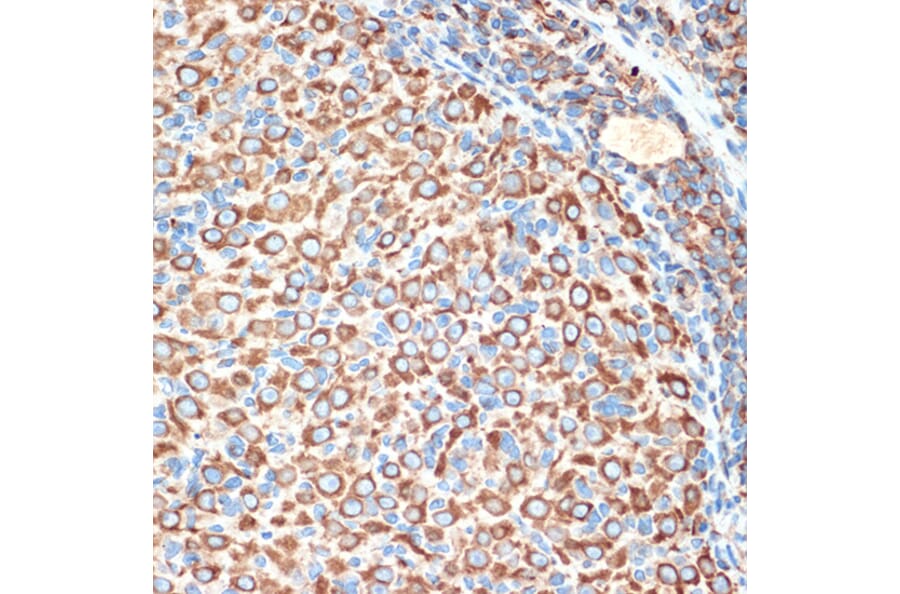 Immunohistochemistry - Anti-Slit2 Antibody [ARC2010] (A306027) - Antibodies.com