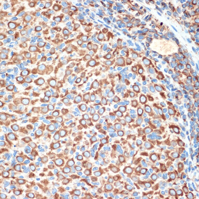 Immunohistochemistry - Anti-Slit2 Antibody [ARC2010] (A306027) - Antibodies.com