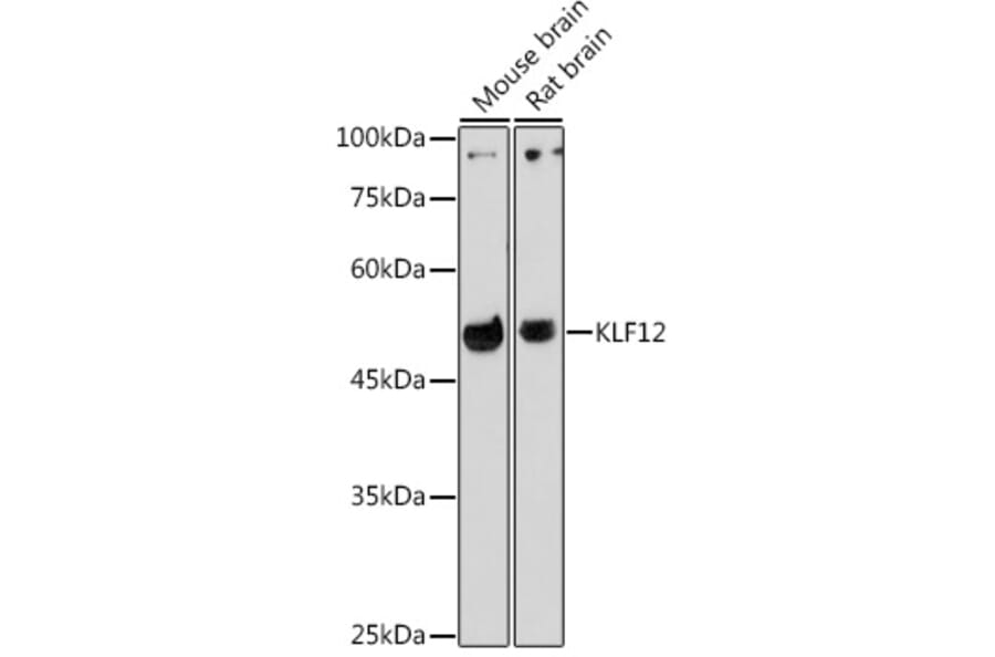 Western Blot - Anti-KLF12 Antibody (A306028) - Antibodies.com
