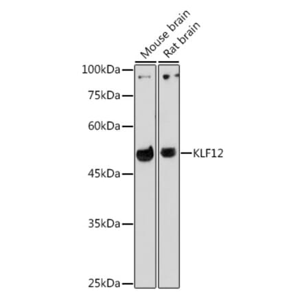 Western Blot - Anti-KLF12 Antibody (A306028) - Antibodies.com