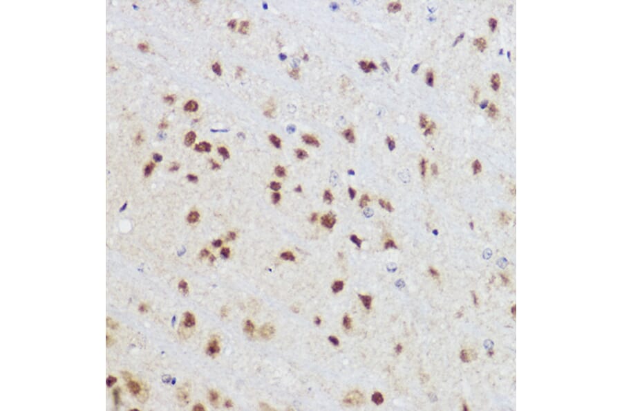 Immunohistochemistry - Anti-KLF12 Antibody (A306028) - Antibodies.com
