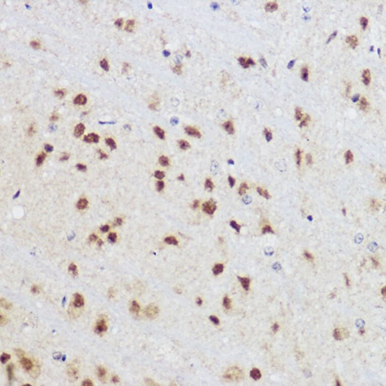Immunohistochemistry - Anti-KLF12 Antibody (A306028) - Antibodies.com