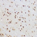 Immunohistochemistry - Anti-KLF12 Antibody (A306028) - Antibodies.com