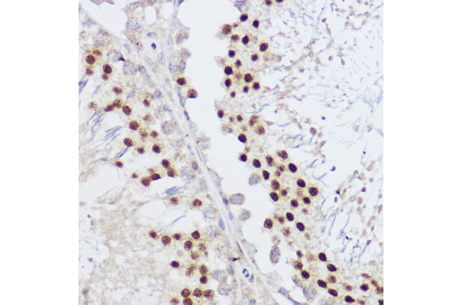 Immunohistochemistry - Anti-KLF12 Antibody (A306028) - Antibodies.com