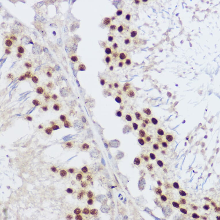 Immunohistochemistry - Anti-KLF12 Antibody (A306028) - Antibodies.com
