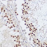 Immunohistochemistry - Anti-KLF12 Antibody (A306028) - Antibodies.com