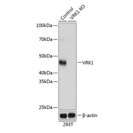 Western Blot - Anti-VRK1 Antibody (A306029) - Antibodies.com