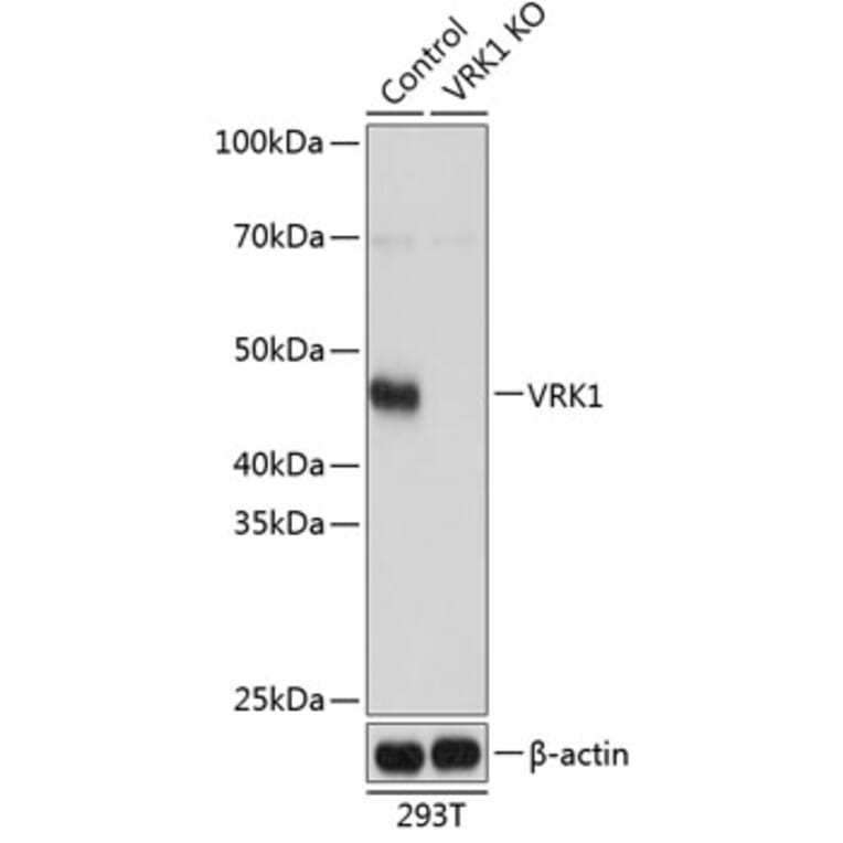 Western Blot - Anti-VRK1 Antibody (A306029) - Antibodies.com
