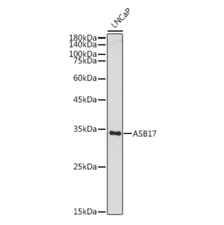 Western Blot - Anti-Asb17 Antibody (A306030) - Antibodies.com