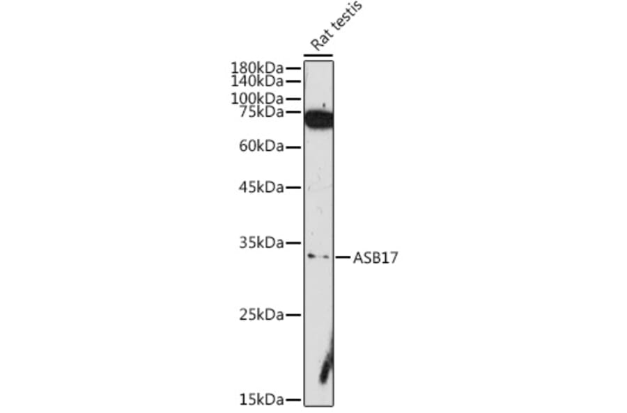 Western Blot - Anti-Asb17 Antibody (A306030) - Antibodies.com