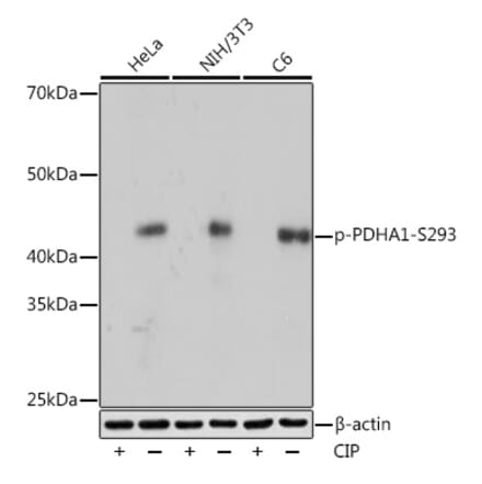 Western Blot - Anti-PDHA1 (phospho Ser293) Antibody [ARC53489] (A306031) - Antibodies.com