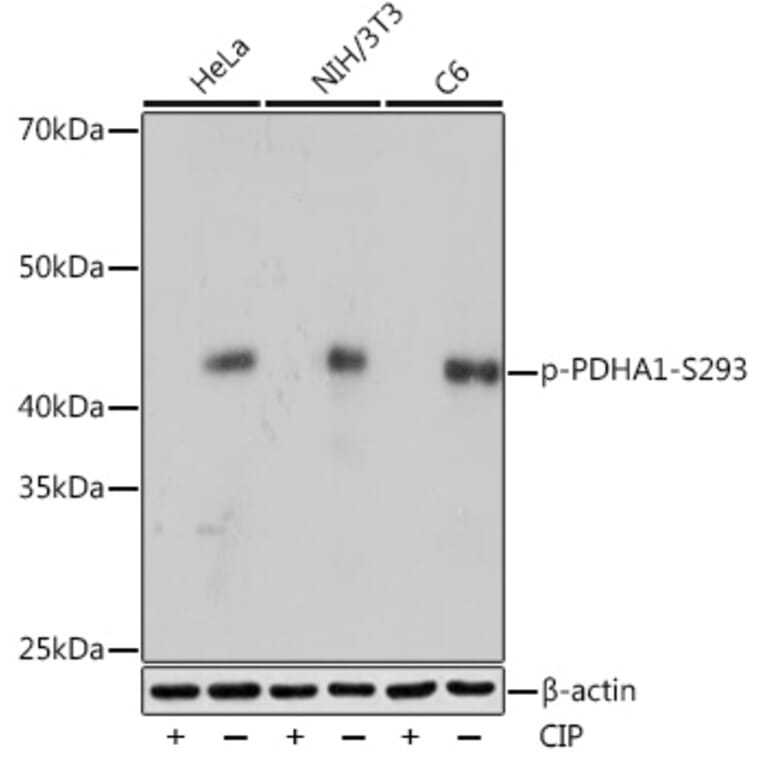 Western Blot - Anti-PDHA1 (phospho Ser293) Antibody [ARC53489] (A306031) - Antibodies.com