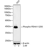 Western Blot - Anti-PDHA1 (phospho Ser293) Antibody [ARC53489] (A306031) - Antibodies.com