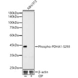 Western Blot - Anti-PDHA1 (phospho Ser293) Antibody [ARC53489] (A306031) - Antibodies.com