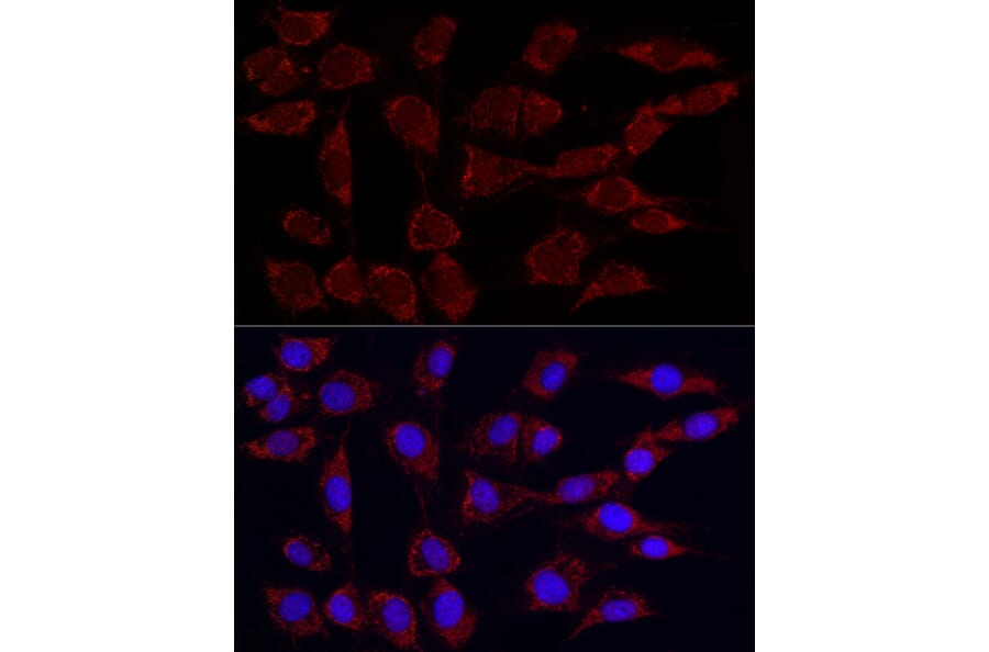 Immunofluorescence - Anti-PDHA1 (phospho Ser293) Antibody [ARC53489] (A306031) - Antibodies.com