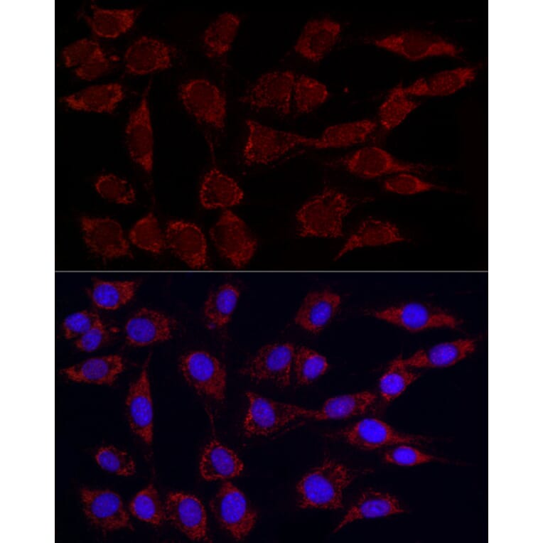 Immunofluorescence - Anti-PDHA1 (phospho Ser293) Antibody [ARC53489] (A306031) - Antibodies.com