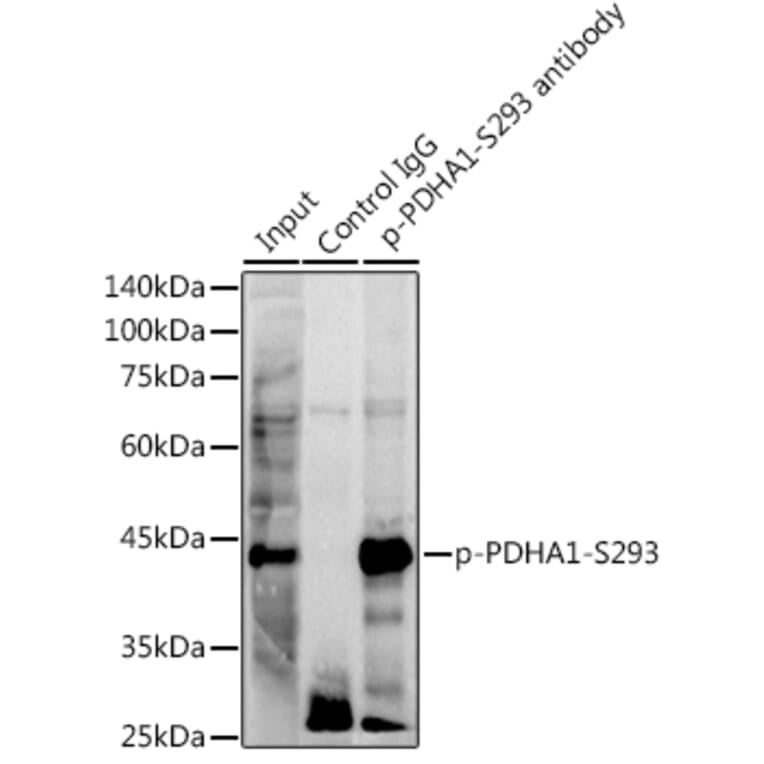 Western Blot - Anti-PDHA1 (phospho Ser293) Antibody [ARC53489] (A306031) - Antibodies.com