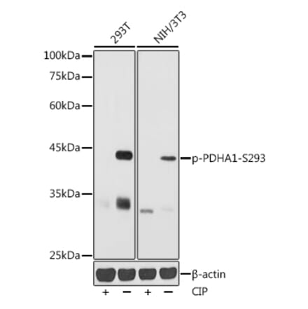Western Blot - Anti-PDHA1 (phospho Ser293) Antibody (A306032) - Antibodies.com