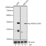 Western Blot - Anti-PDHA1 (phospho Ser293) Antibody (A306032) - Antibodies.com