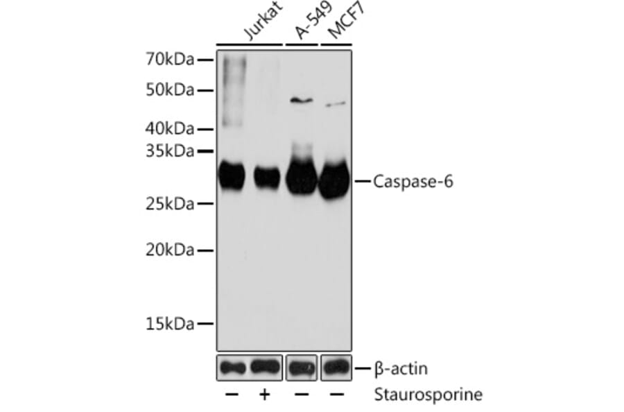 Western Blot - Anti-Caspase-6/CASP-6 Antibody [ARC0031] (A306034) - Antibodies.com