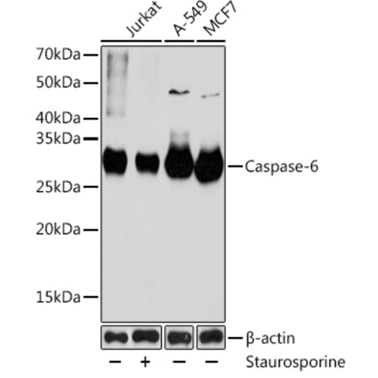 Western Blot - Anti-Caspase-6/CASP-6 Antibody [ARC0031] (A306034) - Antibodies.com