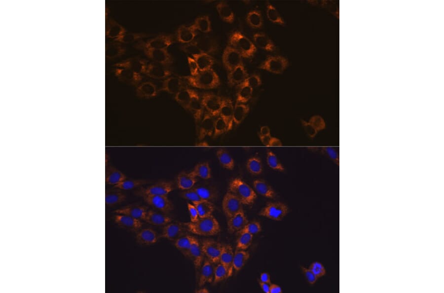 Immunofluorescence - Anti-Caspase-6/CASP-6 Antibody [ARC0031] (A306034) - Antibodies.com