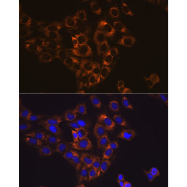 Immunofluorescence - Anti-Caspase-6/CASP-6 Antibody [ARC0031] (A306034) - Antibodies.com