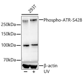 Western Blot - Anti-ATR (phospho Ser428) Antibody [ARC55118] (A306035) - Antibodies.com