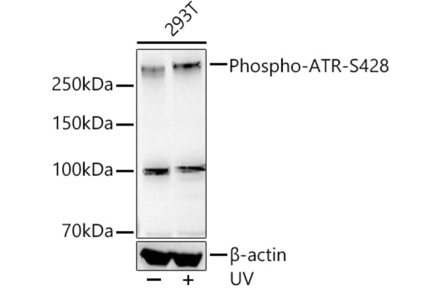 Western Blot - Anti-ATR (phospho Ser428) Antibody [ARC55118] (A306035) - Antibodies.com